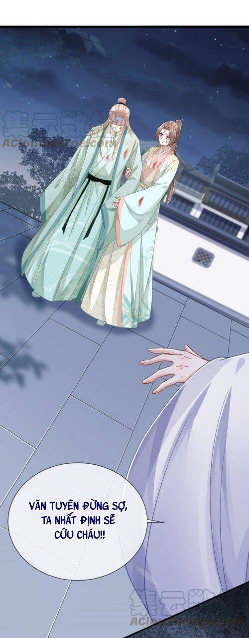 Xuyên Vào Trò Chơi Công Lược Boss Phản Diện Chapter 44 - 2