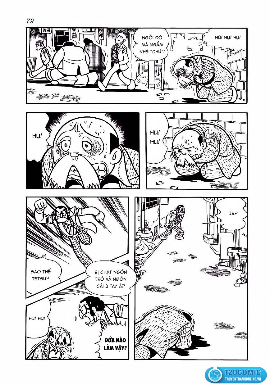 Black Jack Chapter 174 - 11