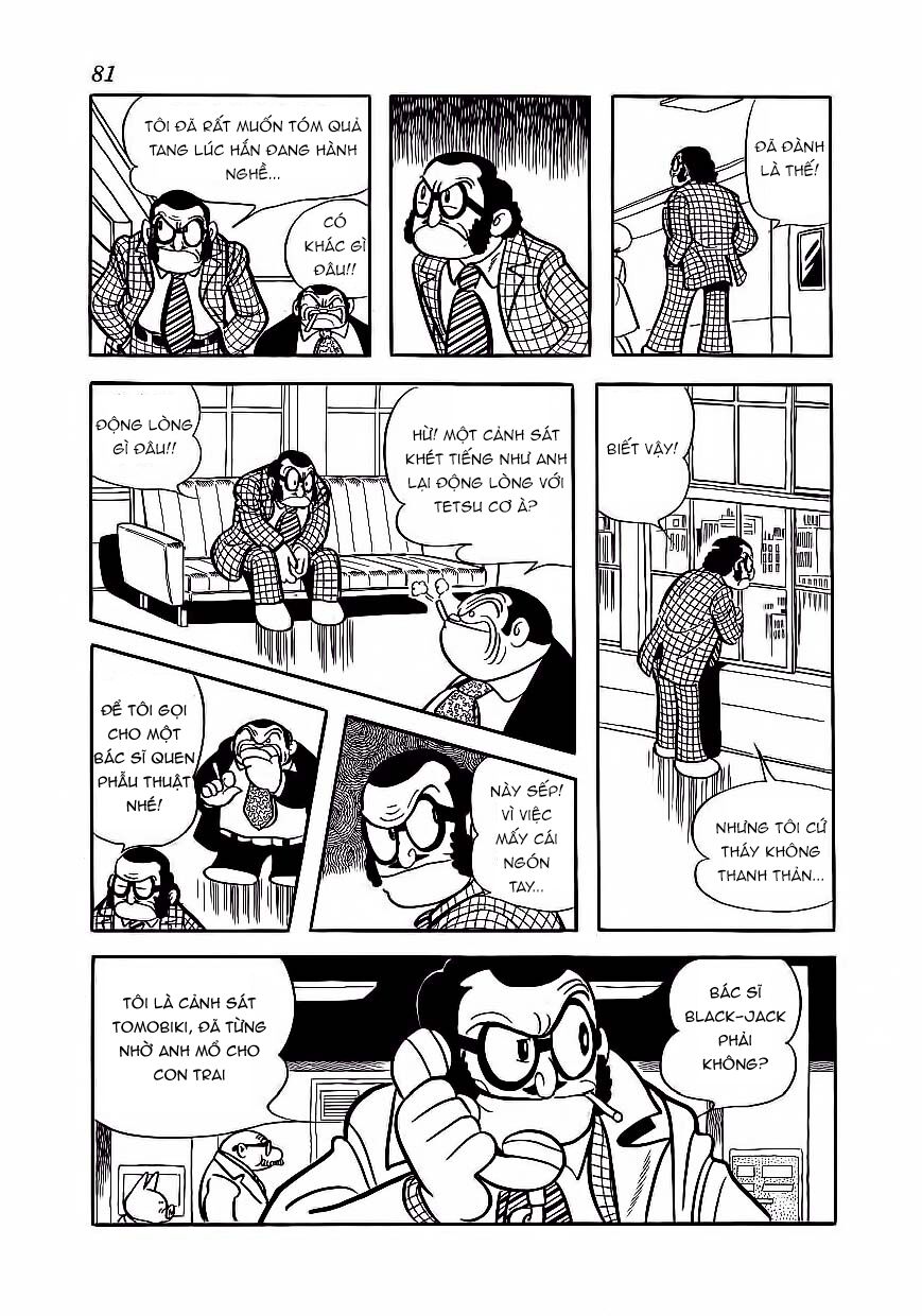 Black Jack Chapter 174 - 13