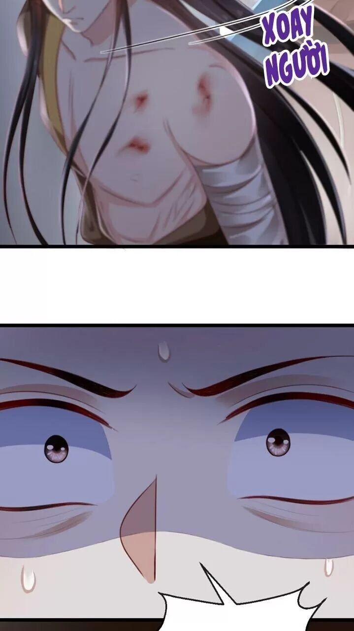 Độc Phi Ngu Ngốc Không Thể Chọc Chapter 117 - 22