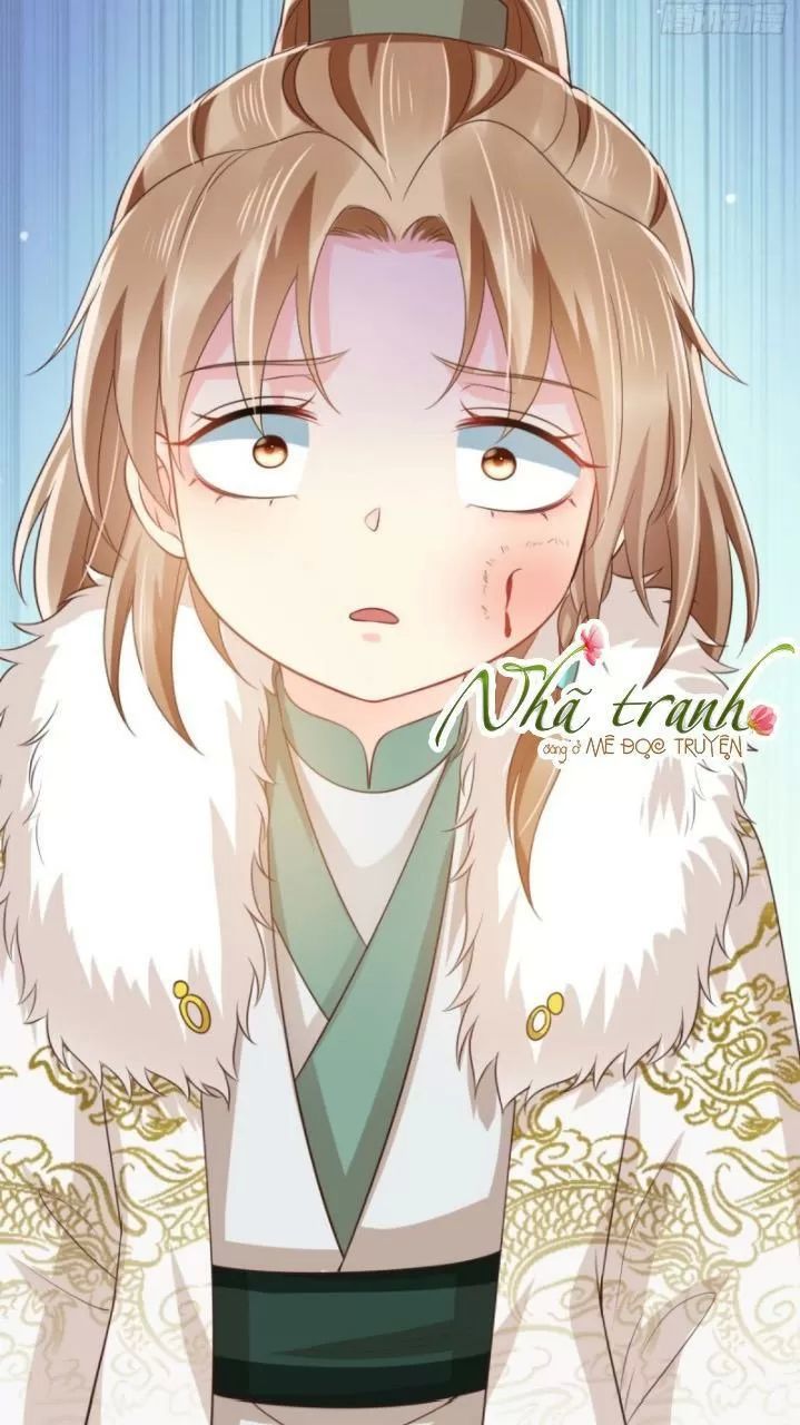 Độc Phi Ngu Ngốc Không Thể Chọc Chapter 152 - 17