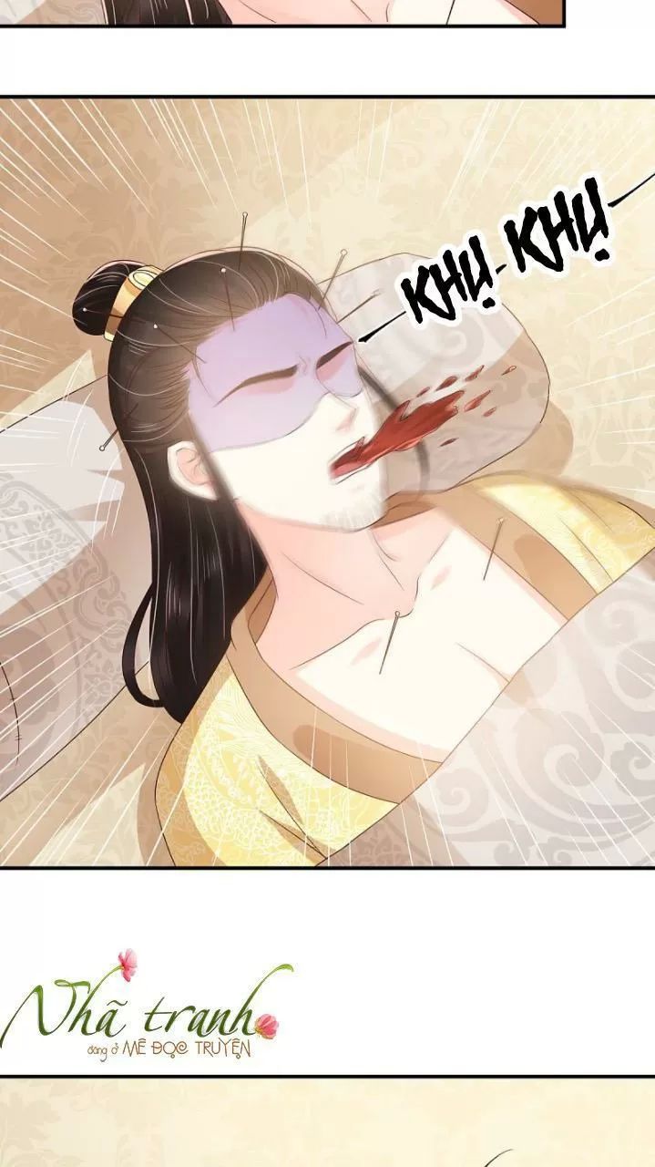 Độc Phi Ngu Ngốc Không Thể Chọc Chapter 153 - 34