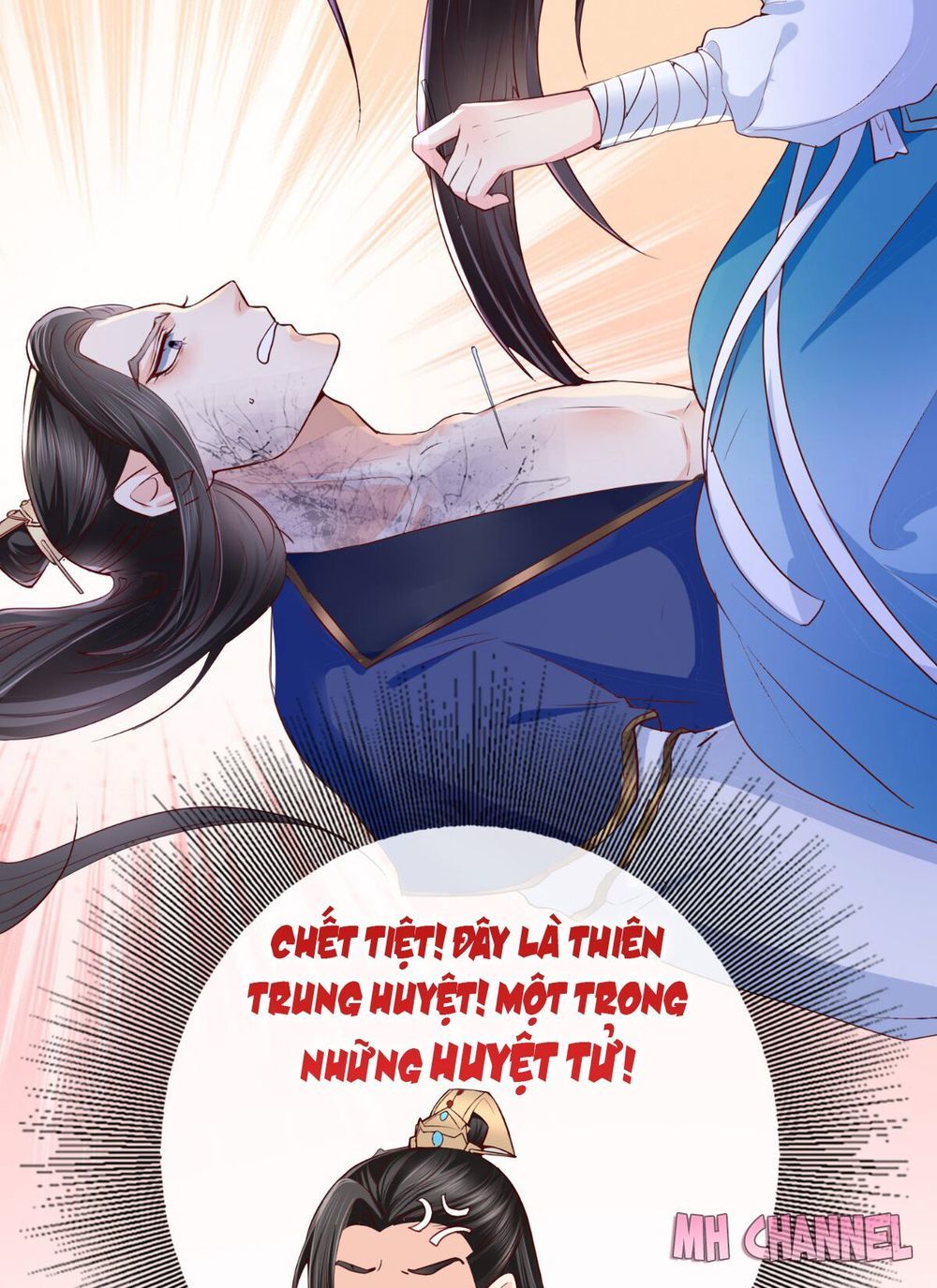 Độc Phi Ngu Ngốc Không Thể Chọc Chapter 6 - 26