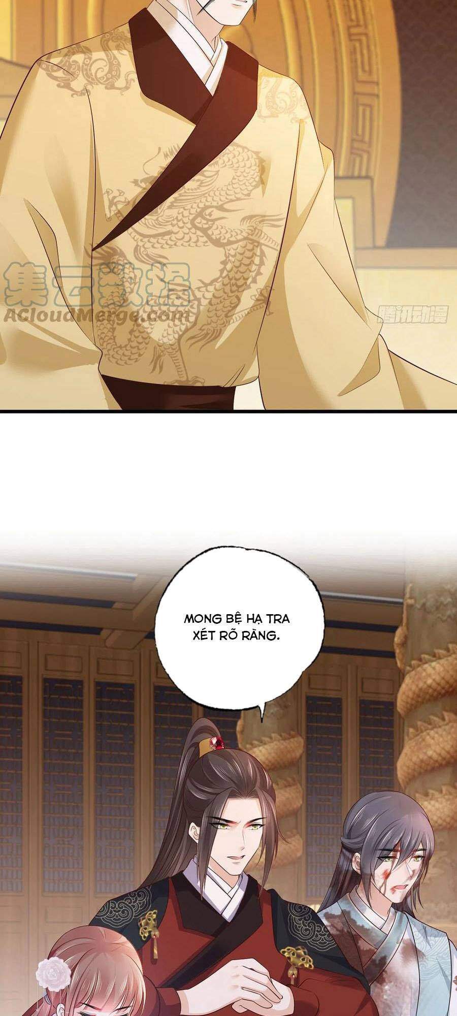 Nữ Thủ Phú Chi Kiều Sủng Nhiếp Chính Vương Chapter 121 - 10