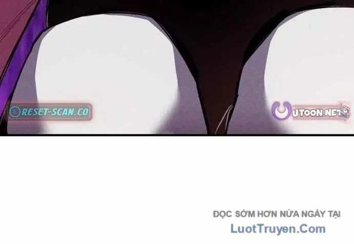 Lây Nhiễm - Làm Sóng Zombie Chapter 13 - 180