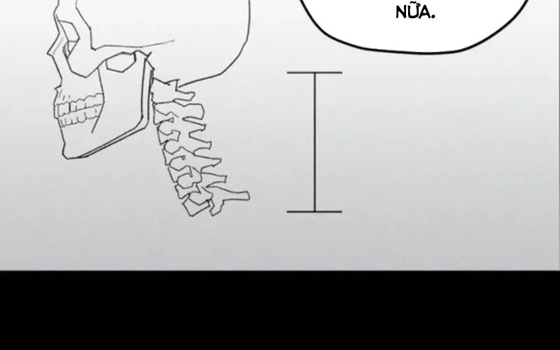 Lây Nhiễm - Làm Sóng Zombie Chapter 5 - 12