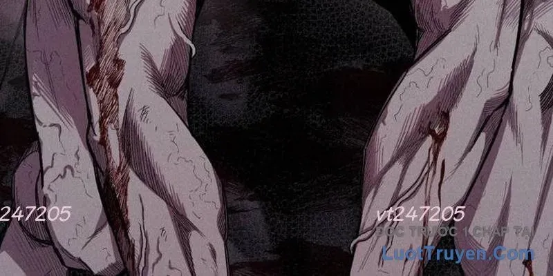 Lây Nhiễm - Làm Sóng Zombie Chapter 8 - 11