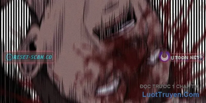 Lây Nhiễm - Làm Sóng Zombie Chapter 8 - 186