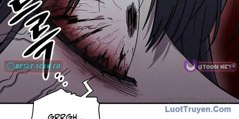 Lây Nhiễm - Làm Sóng Zombie Chapter 8 - 246