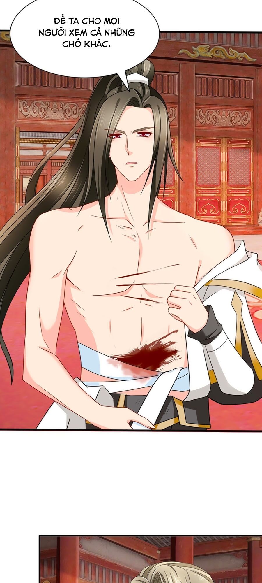 Kiêu Sủng Y Phi Chapter 175 - 31