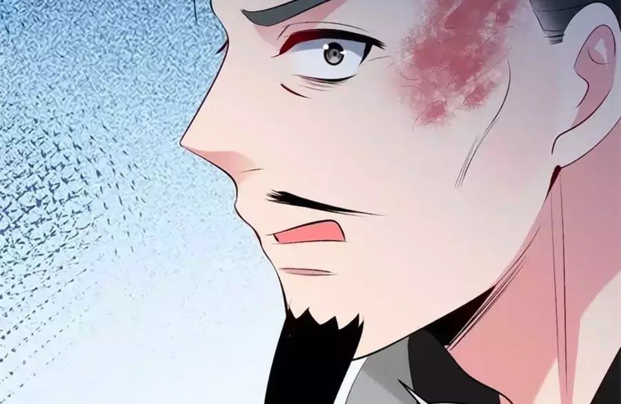 Tuyệt Thế Thần Y: Phúc Hắc Đại Tiểu Thư Chapter 34 - 82