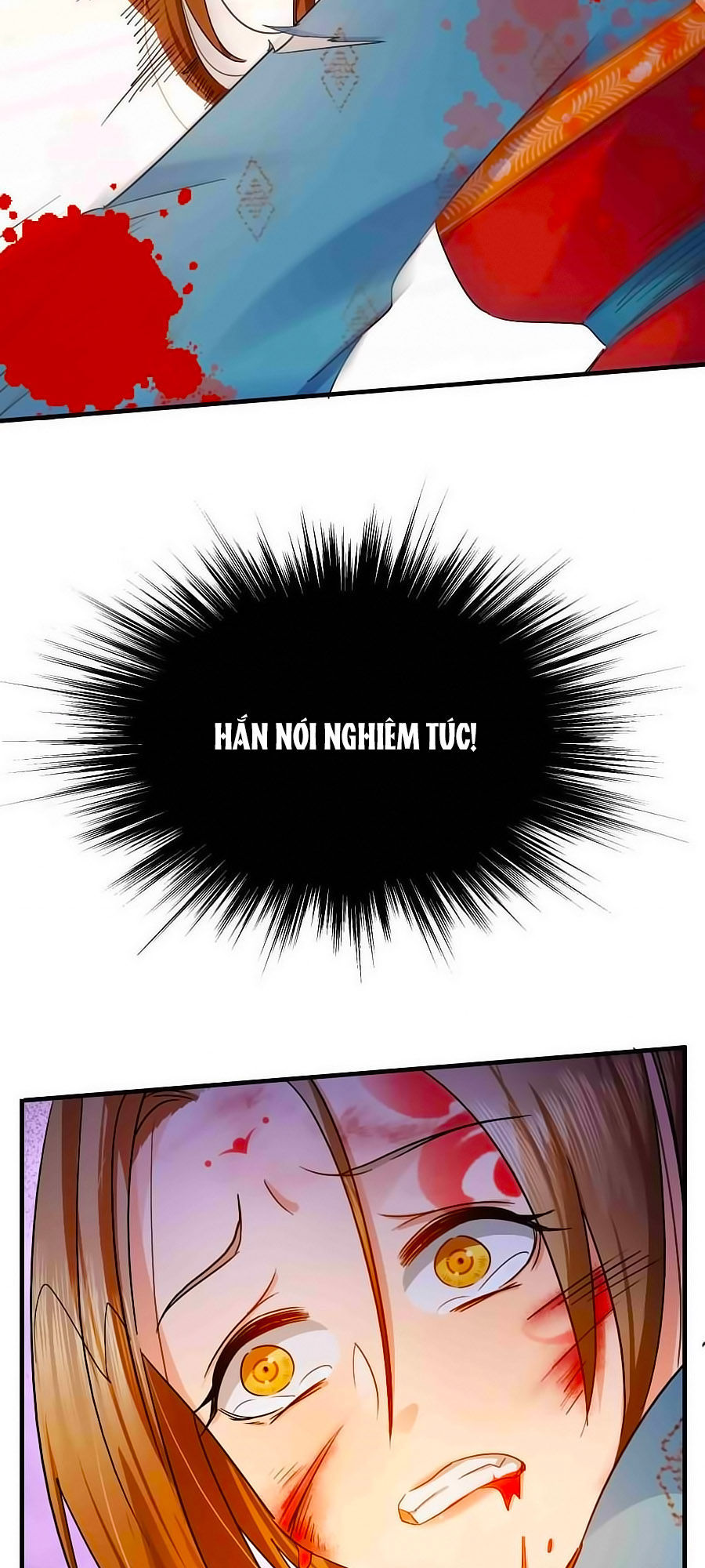 Kiêu Sủng Y Phi Chapter 6 - 45