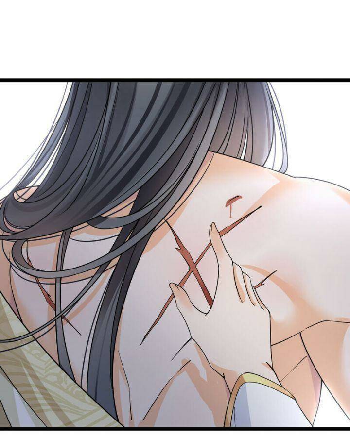 Nụ Cười Của Ngươi Ngọt Đến Mức Làm Gãy Tám Cái Răng Của Ta Chapter 91 - 41