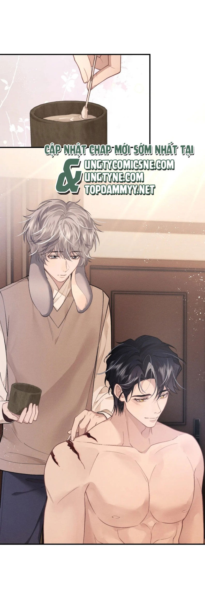 Chấp Sự Thỏ Cụp Tai Chapter 148 - 26