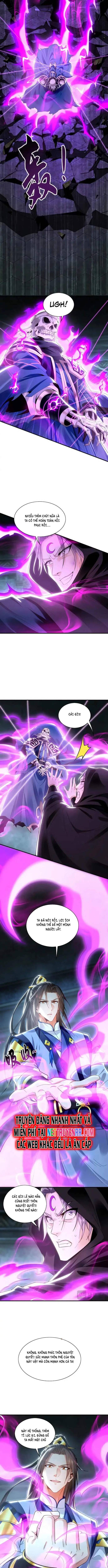 Ta Có Trăm Vạn Tốc Độ Đánh Chapter 94 - 5