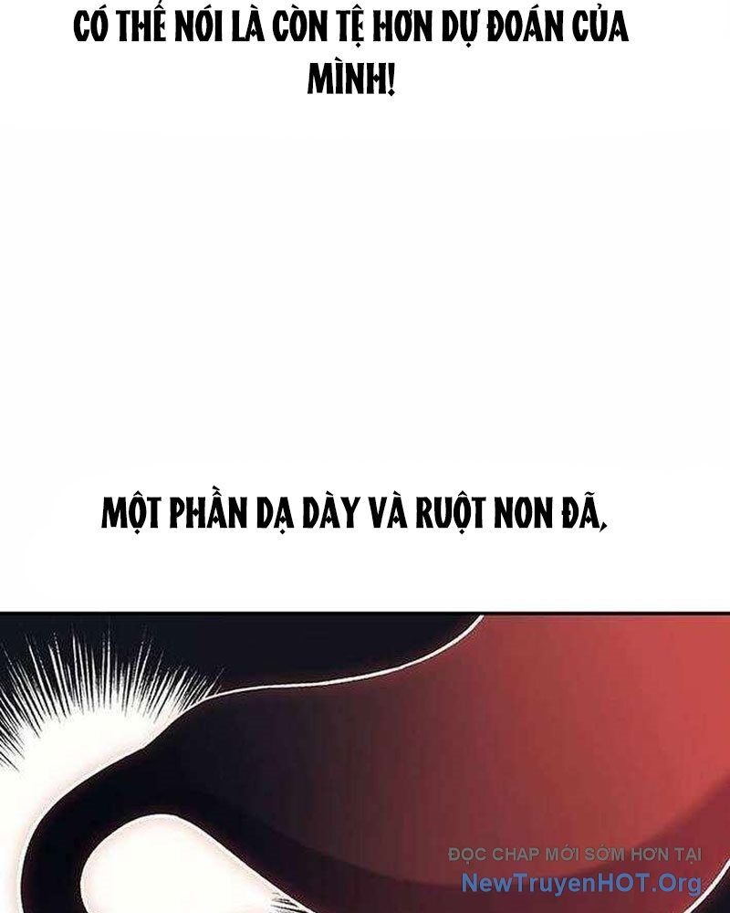 Bác Sĩ Tới Joseon Chapter 51 - 46