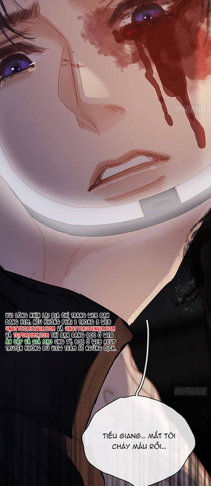 Ngày Dài Gặp Người Khuyết Tâm Nhãn Chapter  7 - 18