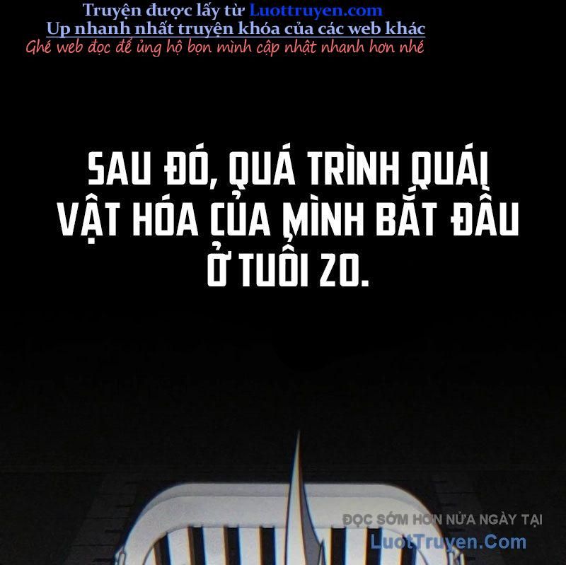 Healer Cấp S Chữa Trị Cho Quái Vật Chapter 17 - 50