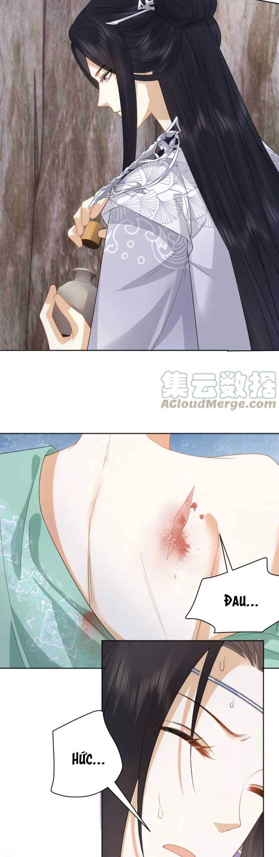 Vương Gia Cuồng Ghen Tuông Chapter 34 - 31